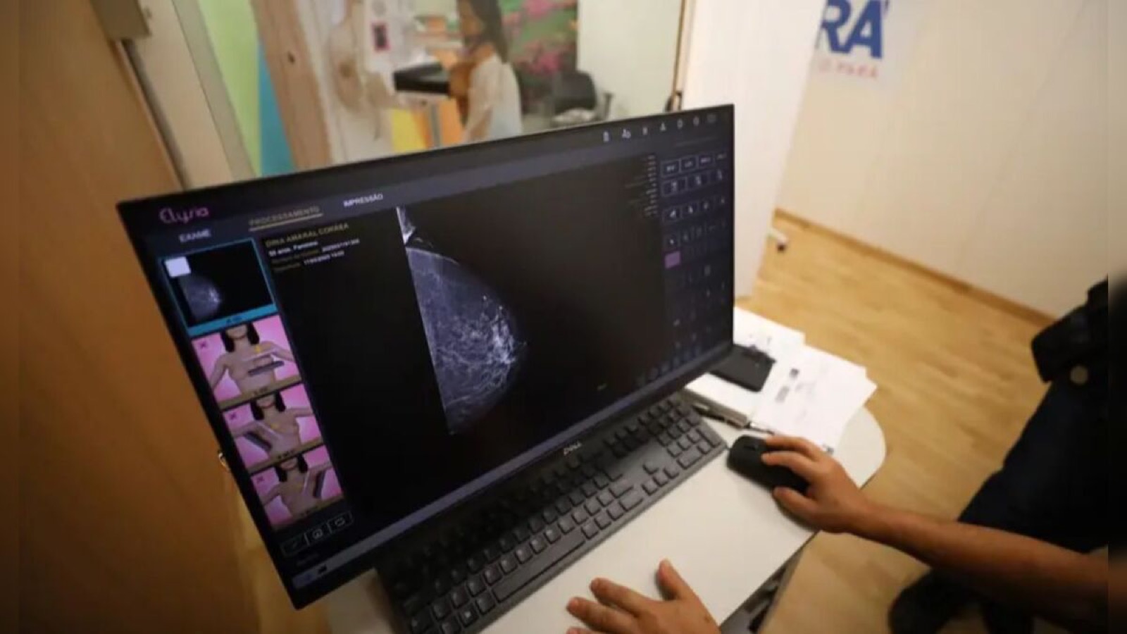 Pará realiza mais de 9 mil mamografias em carretas da saúde